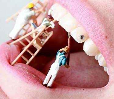 Bleaching by eDEL weiss zahnkosmetik