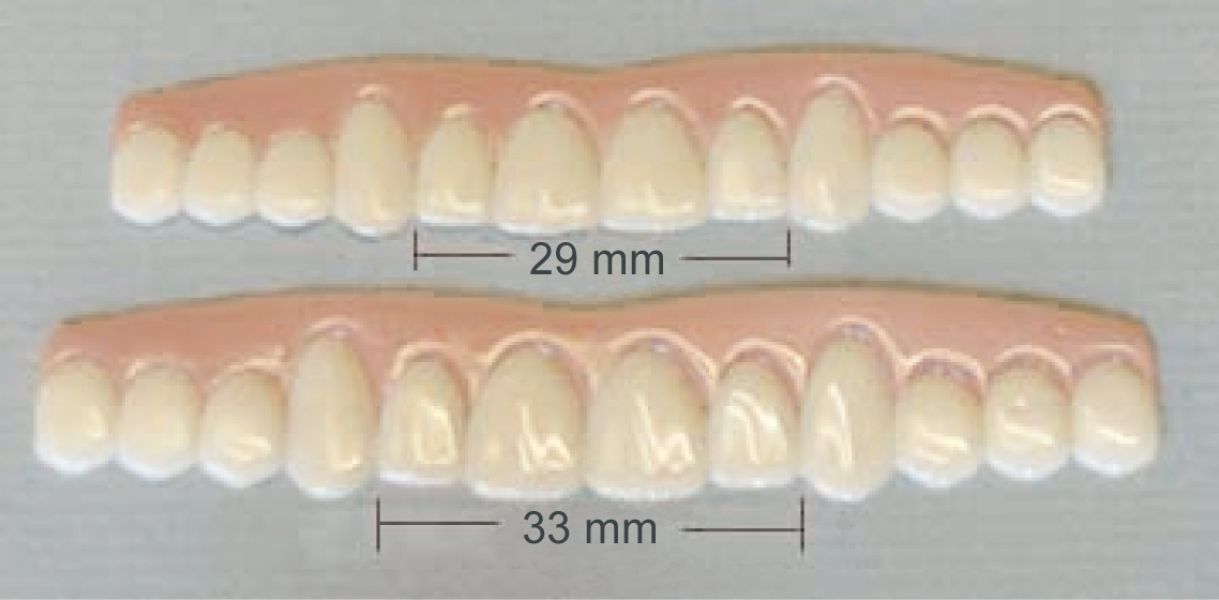 Nicht Die Perfekten Zähne? Wir Haben Die Lösung!