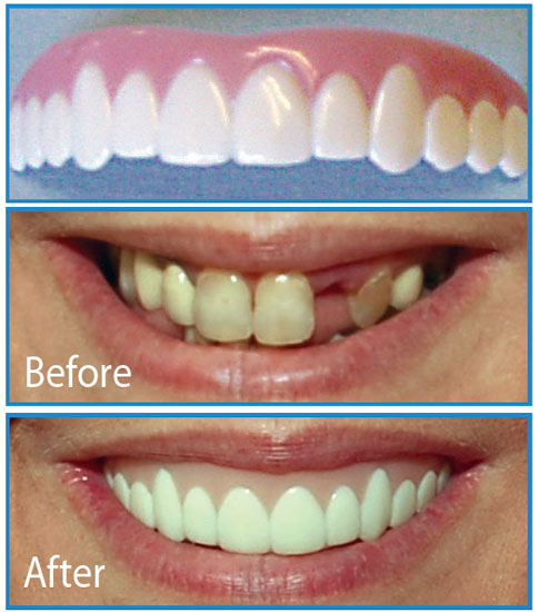 Perfektes Aussehen Ihrer Zähne? Wir Haben Die Lösung!